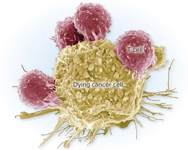 Destruction of a cancer cell by cytotoxic T cells
