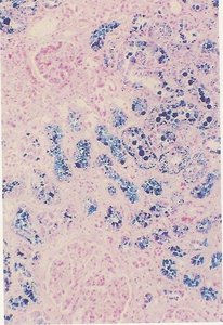 Haemosiderin in kidney, Perls' reaction