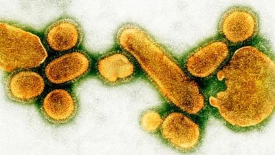 Virus particles (influenza)