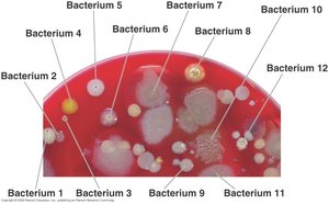 Bacterial colony morphologies
