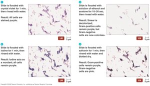 Gram stain results under microscope