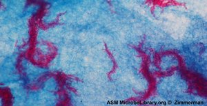 Acid-fast stained Mycobacterium tuberculosis