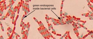 Endospore stain results