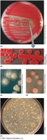 Bacterial colonies on solid media