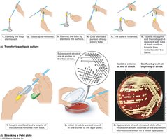 Aseptic technique and streak plate method