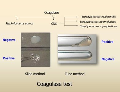 Coagulase test