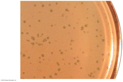 Viral plaques formed by bacteriophages