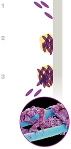 Biofilm formation stages and SEM of dental biofilm
