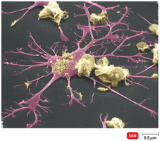 Dendritic cell as an antigen-presenting cell