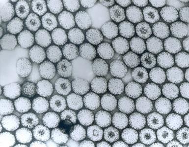 Electron micrograph of bacterial endospores