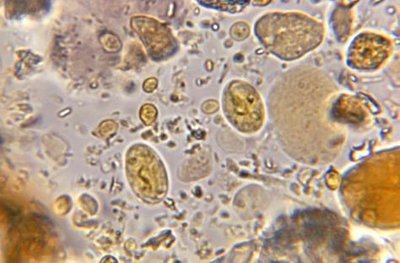 Protozoan cysts under microscope