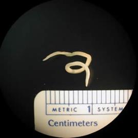 Helminth egg or worm