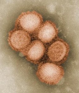 Enveloped viruses under electron microscope