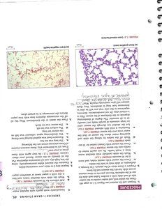 Microscopic images of Gram-positive and Gram-negative bacteria