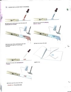 Stepwise Acid-fast staining procedure