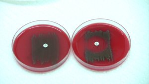 Optochin disc test for Streptococcus pneumoniae