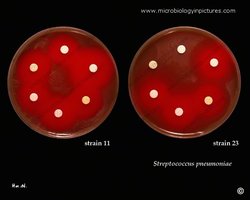 Optochin susceptibility test for Streptococcus pneumoniae