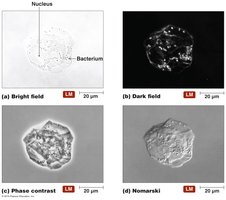 Four kinds of light microscopy