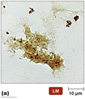 Fluorescence microscopy