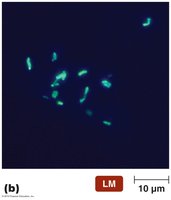 Fluorescent bacteria under microscope