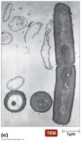 SEM image of fungi