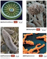 SEM image of bacteria