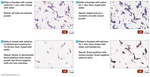 Gram staining procedure