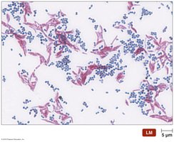 Ziehl-Neelsen acid-fast stain