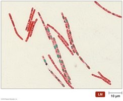 Schaeffer-Fulton endospore stain of Bacillus
