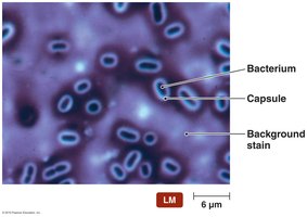 Negative (capsule) stain of Klebsiella pneumoniae