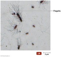Flagellar stain of Proteus vulgaris