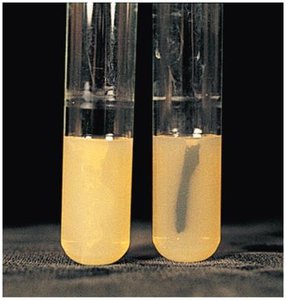 Biochemical test tubes