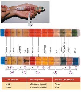 EnteroPluri rapid identification system