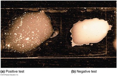 Slide agglutination test