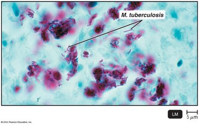 Capsule, endospore, and flagella staining