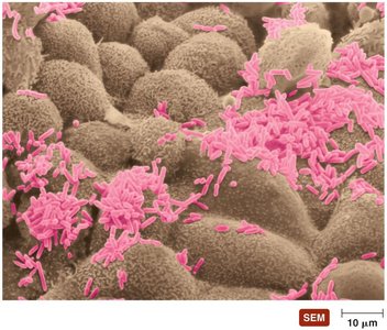 SEM of normal microbiota on a surface