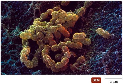 SEM of dental plaque biofilm