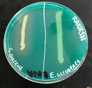 DNase test plate showing positive and negative results