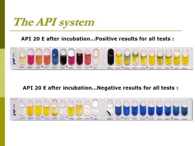 API 20E test strip with positive and negative results