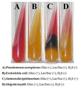 TSIA slants showing various fermentation and H2S results