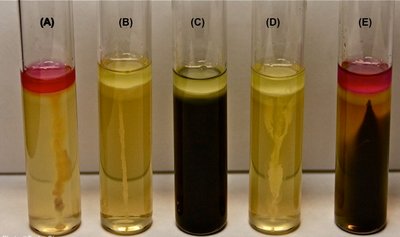 Litmus milk tubes showing different reactions