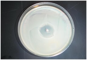 Zone of inhibition in bacterial lawn