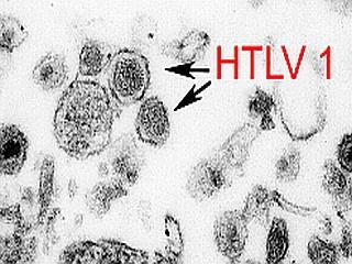 HTLV-1 electron micrograph