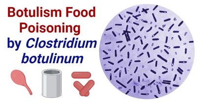 Clostridium botulinum (phage conversion example)