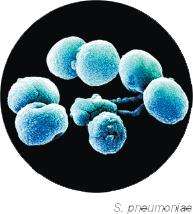 Streptococcus pneumoniae under electron microscopy