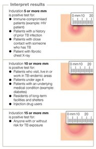Interpretation of tuberculin skin test results