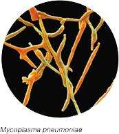 Mycobacterium tuberculosis under microscopy