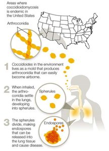 Blastomycosis infection cycle and endemic regions