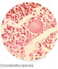 Blastomyces dermatitidis under microscopy