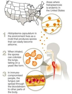 Coccidioidomycosis infection cycle and endemic regions